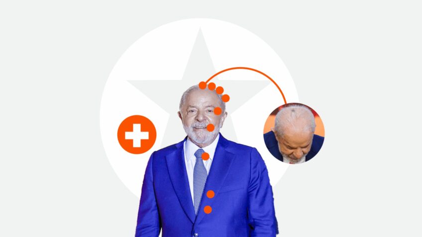 Lula já passou pela amputação do dedo mindinho da mão esquerda, em 1964, e pelo tratamento de um câncer de laringe, em 2011