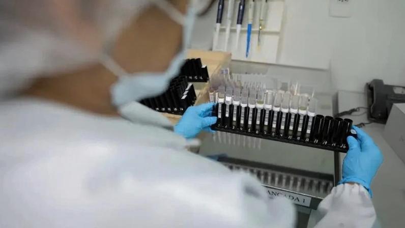 Na imagem, mulher realiza testes laboratoriais