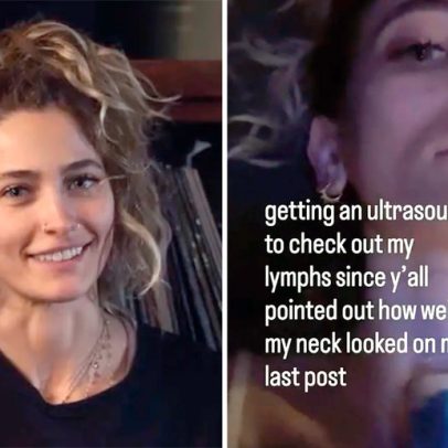 Paris Jackson faz ultrassom após alerta de fãs sobre pescoço