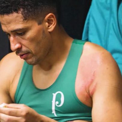 Palmeiras mostra cicatrizes em Murilo após entrada de Carrascal, do Flamengo