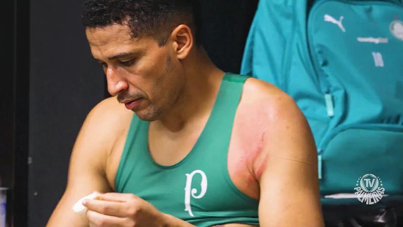 Murilo ficou com cicatriz na pele após entrada de Carrascal em Flamengo x Palmeiras — Foto: Reprodução