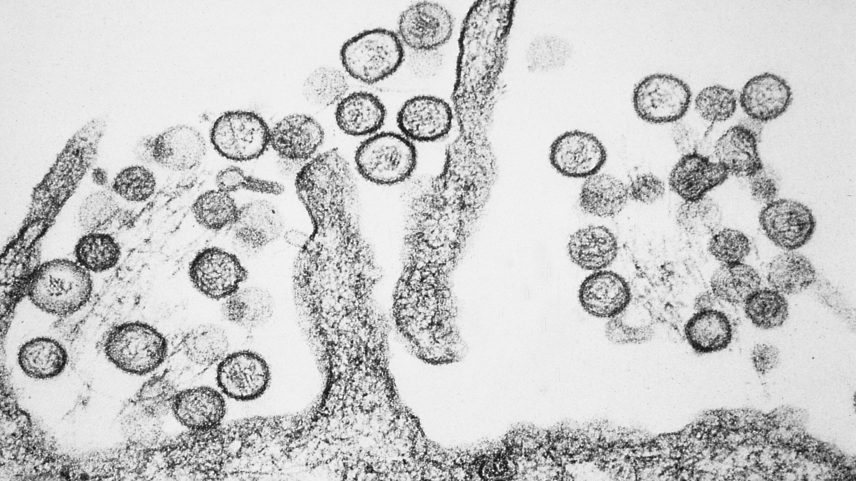 Reprodução de imagem do hantavírus visto por um microscópio. — Foto: CDC/Cynthia Goldsmith
