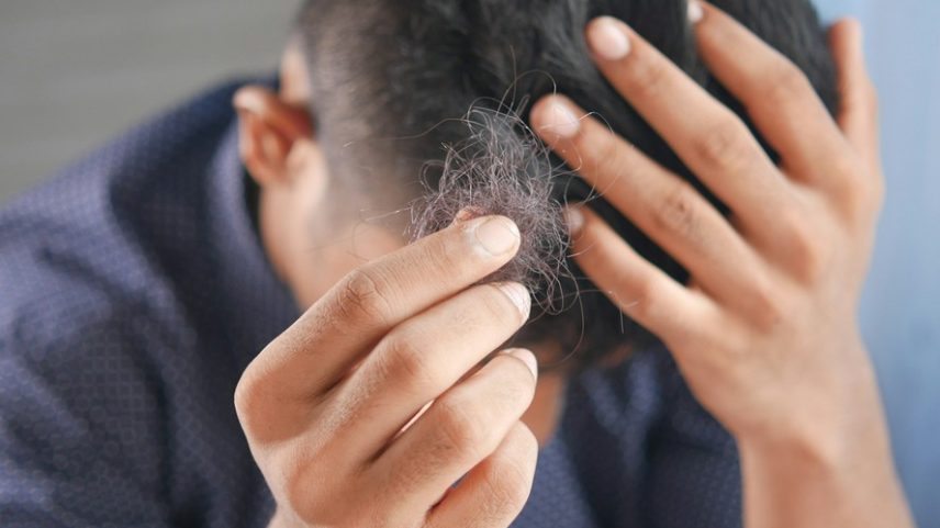 A queda de cabelo pode ter relação com absorção de ferro