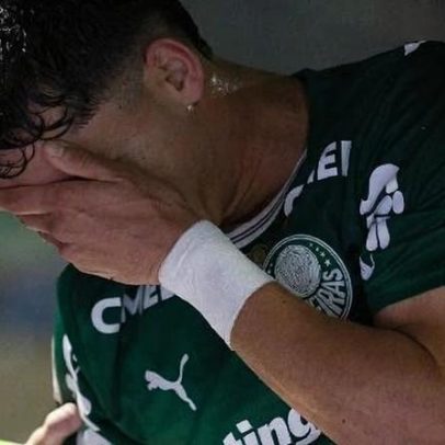 Abel enfrenta lesões em série: ataque em dificuldade e zaga sob pressão