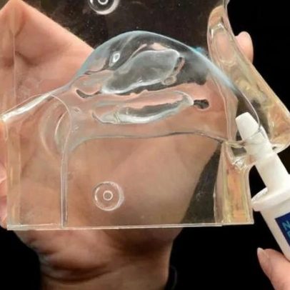 Pesquisadores de Hong Kong desenvolvem spray para tratamento de AVC