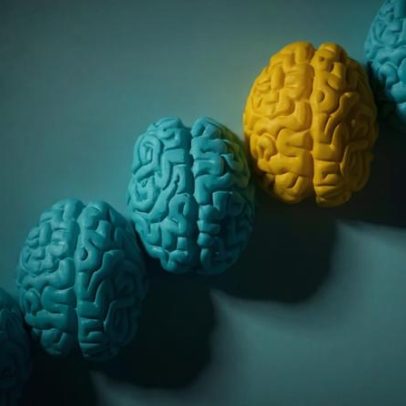 Pesquisa identifica dois subtipos de autismo pela conectividade cerebral