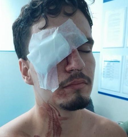 Torcedor levou tiro de bala de borracha no olho em saída de Flamengo x Vasco, no Maracanã