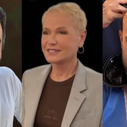 Famosos que fizeram transplante capilar, incluindo Xuxa