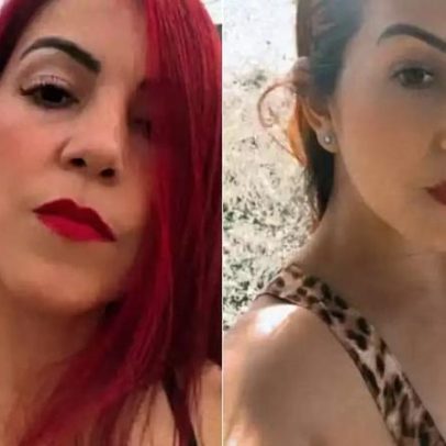 Mulher morre após cirurgia plástica em SP; polícia investiga complicações