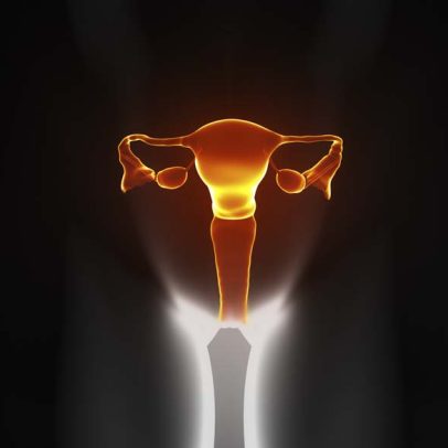 Doença que afeta 170 milhões de mulheres terá novo nome