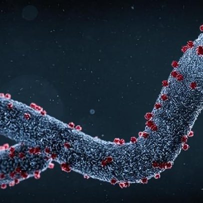 Ebola: cronologia da doença e causas de surtos na África