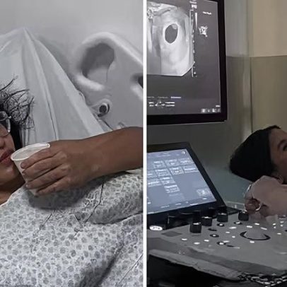 Mãe de dois descobre gravidez após laqueadura