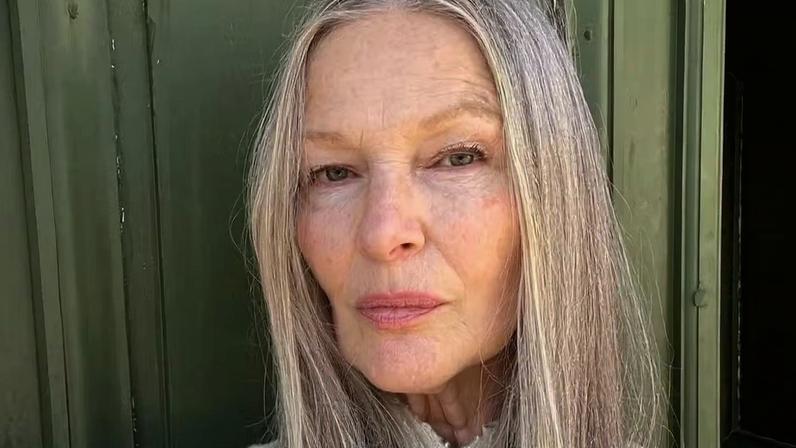 Menopausa pede novos cuidados com a pele — Foto: Reprodução/Instagram @ameliabackman
