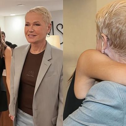 Xuxa celebra resultado de transplante capilar que a fez bem