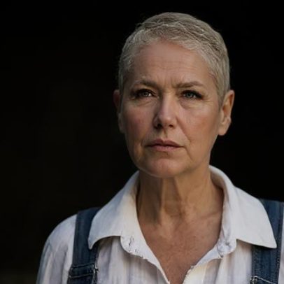 Xuxa sofre de alopécia androgenética: entenda a condição que afeta mulheres