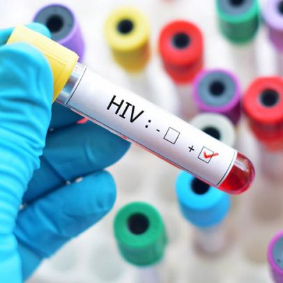 Queda de ajuda internacional ameaça combate ao HIV, alerta ONU