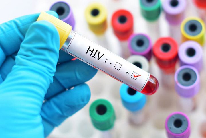 A aprovação pela Anvisa se limita à prevenção da infecção pelo HIV-1, não sendo aplicada à variante HIV-2. - (crédito: PRess Serbia - Flickr)
