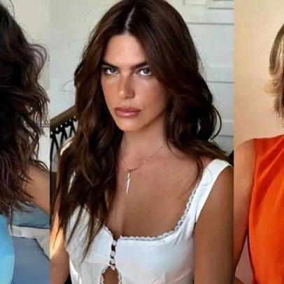 Celebridades confessam arrependimento com Botox e debatem estética natural