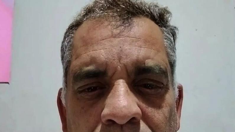Ajude Marcelo a Ver o Mundo Novamente: Cirurgia de Retina em Risco