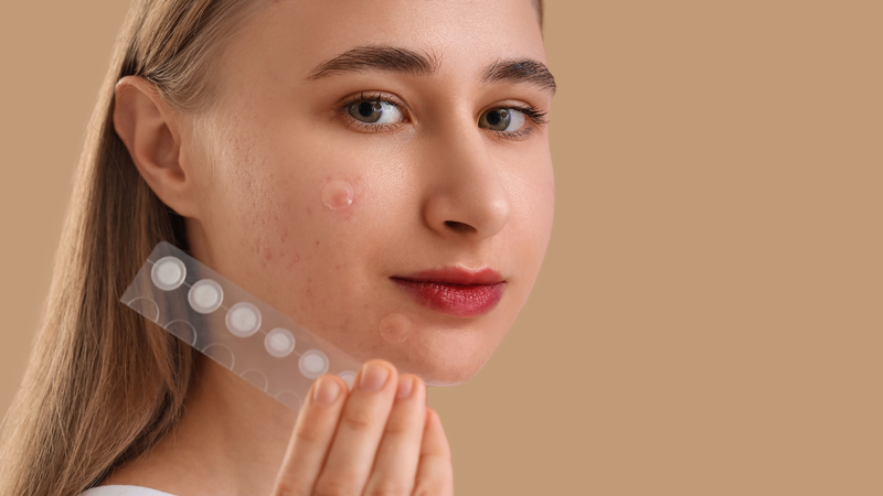 Adesivos para espinhas funcionam? Dermatologista explica