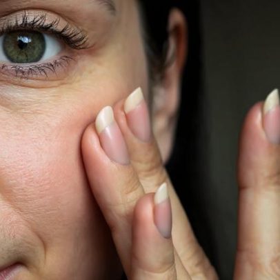 Frio resseca a pele? Dicas para evitar o ressecamento