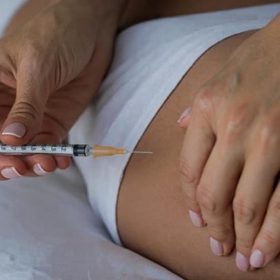 Conselho de Medicina endurece regras e proíbe preenchimento com PMMA