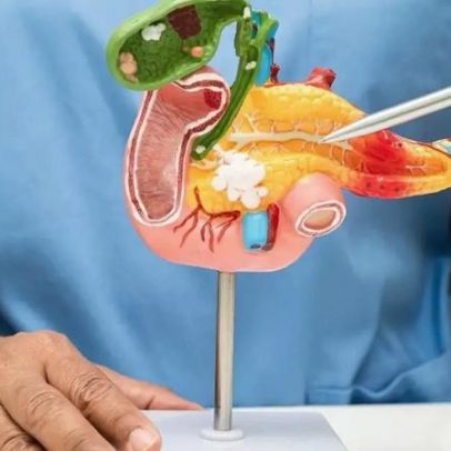 Pancreatite aguda x crônica: diferenças e impactos no tratamento