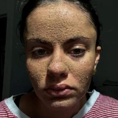 Caveman Skincare pode prejudicar a pele, segundo especialistas