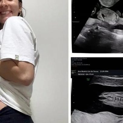Mãe luta pela saúde do filho Francisco