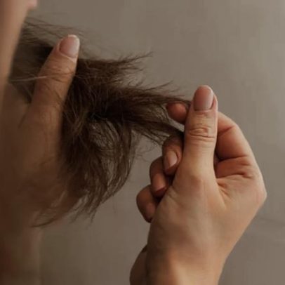 Medicina alerta sobre relação entre canetas de emagrecimento e queda de cabelo