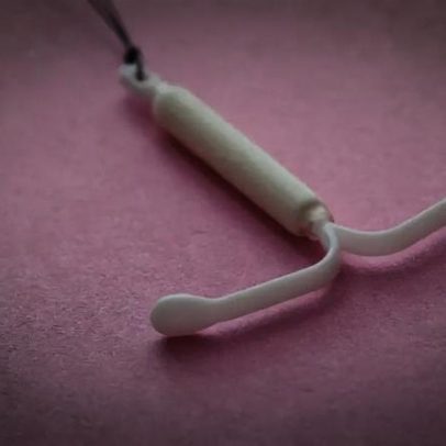 Desmistificando o DIU, o que é, como funciona e possíveis efeitos