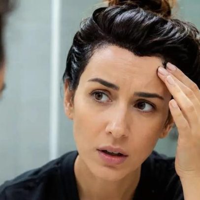 Como remover manchas de tinta de cabelo da pele sem irritação