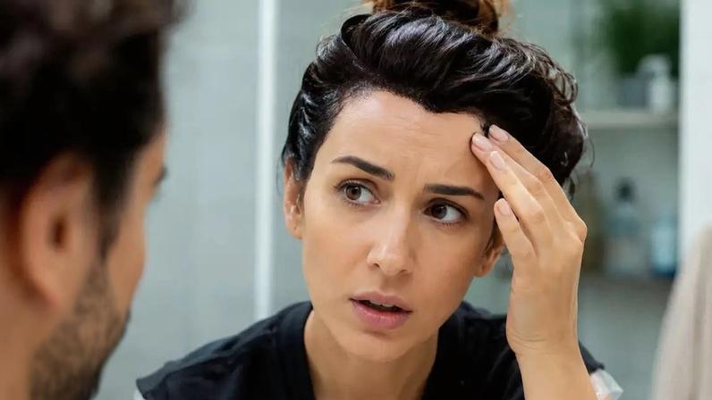 Tingiu o cabelo e manchou a pele? Veja como remover sem sofrimento