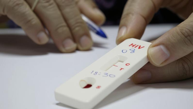 O teste rápido de HIV funciona detectando a presença de anticorpos contra o vírus a partir de uma pequena amostra de sangue ou fluido oral e sai em cerca de 15 a 30 minutos — Foto: Saúde Bahia/Flickr