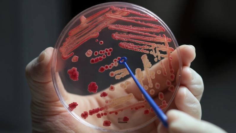 Técnicos trabalham com cultura bacteriana em laboratório