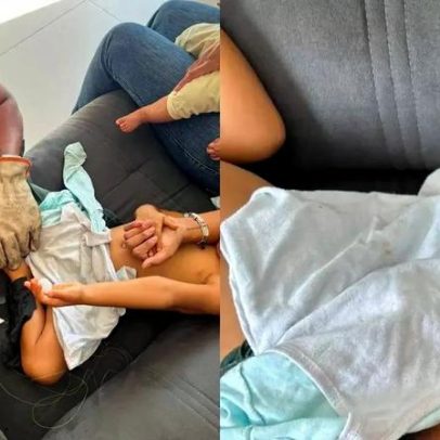 Criança de 3 anos fica presa ao sofá após uso de supercola em MG