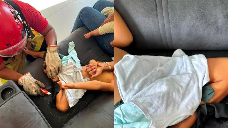 Criança de 3 anos fica grudada em sofá após passar supercola em Minas Gerais
