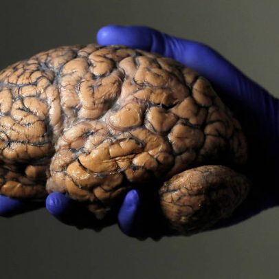 Como o cérebro processa dois idiomas: avanços em bilinguismo