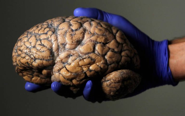 Cérebro mantido em coleção em hospital em Duffel, na Bélgica