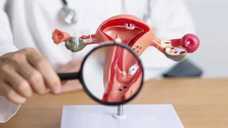 Nem todo mioma uterino exige cirurgia; em muitos casos, o acompanhamento médico é suficiente