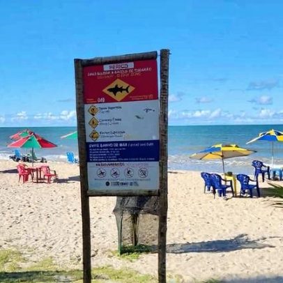 Menino mordido por tubarão em PE tem perna amputada e permanece em estado grave
