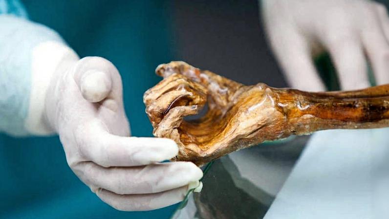 Um pesquisador examina a mão dos restos naturalmente mumificados de Ötzi