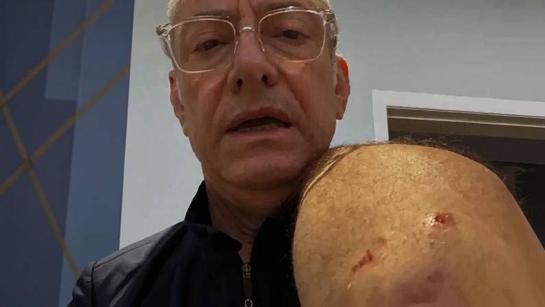 Âncora da Globo, José Roberto Burnier leva 4 pontos após ataque de pitbull sem guia: ‘O preço da irresponsabilidade’.