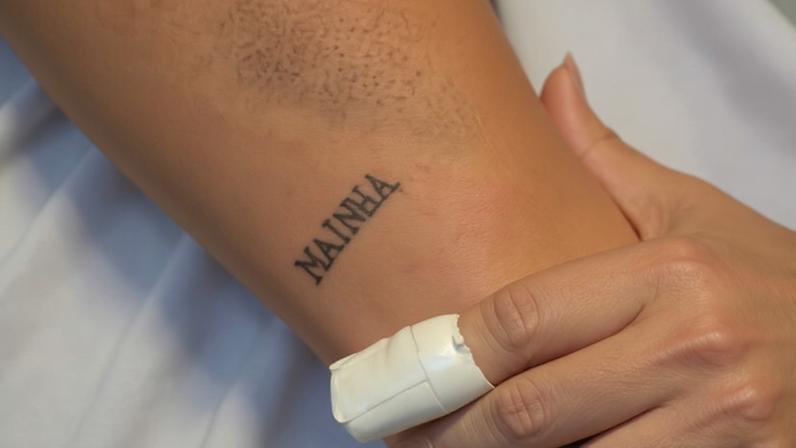 Lesões no corpo de nutricionista que sofreu tentativa de estupro em Barueri (SP); vítima executou mata-leão em homem que invadiu seu apartamento