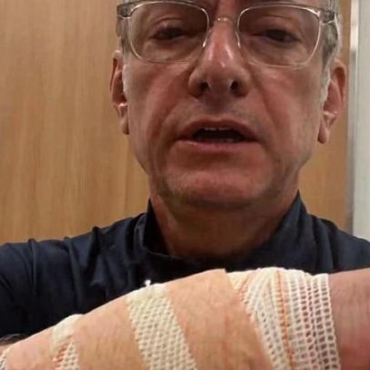 José Roberto Burnier é mordido por pitbull e informa estar estável