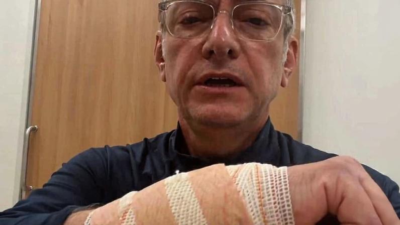 José Roberto Burnier mostra curativos após mordida de cão