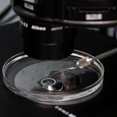 Cientistas editam genes de embriões humanos com alta precisão