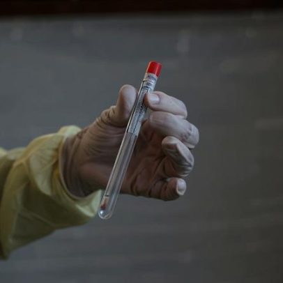 Cientista da vacina contra Covid é acusado de tentar contrabandear mpox