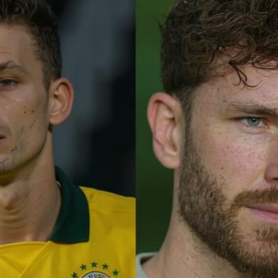Zagueiro da Copa do Mundo, Léo Pereira mudou após cirurgias plásticas