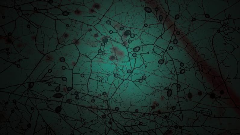 Imagem microscópica mostra uma rede complexa de neurônios com extensões ramificadas finas em vermelho sobre fundo azul esverdeado. Núcleos escuros e ovais estão distribuídos ao longo das ramificações, evidenciando a estrutura celular.